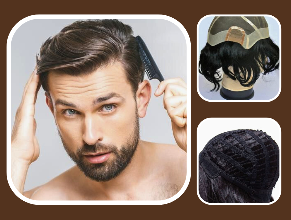 Men's Hair Solutions in Veronica Hair Replacement Solution: Wigs & Patch Fixing Near You