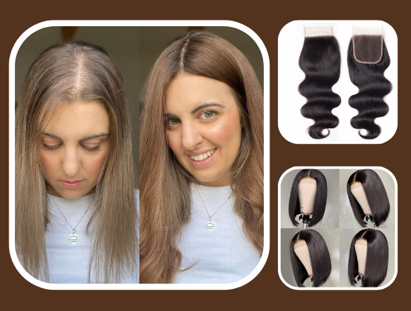 Premium Women's Hair Solutions: & Closures in Veronica Hair Replacement Solution