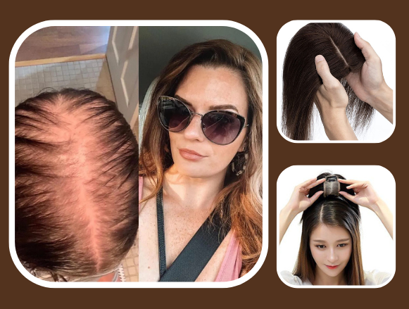 Enhance Your Look with Human Hair Toppers for Women 