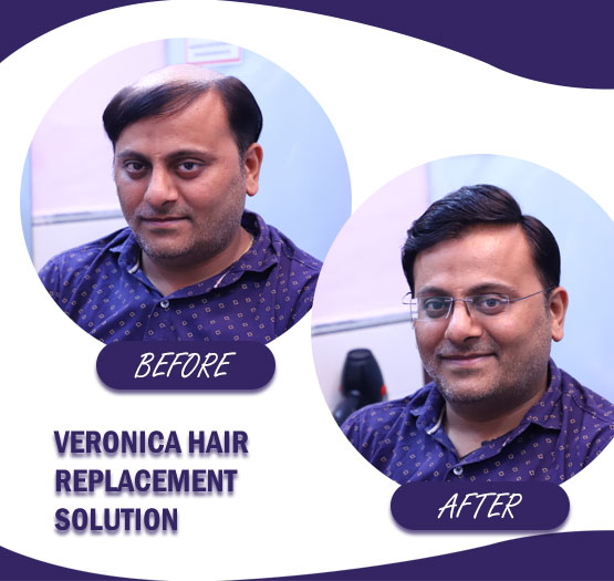 Hair Wigs, Hair Patch, Hair Extension Services | Veronica Hair Replacement