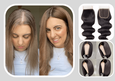 Best Women's Hair Closures, hair closure service near you, Women Hair Closure in Delhi NCR, frontal hair closure, lace frontal closure ear to ear